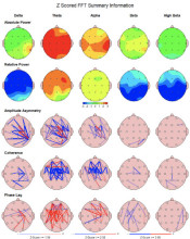 Andy Petranek Brain Scan